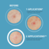 Patchs SOS Boutons 18 hydrocolloïdes Iroha Nature