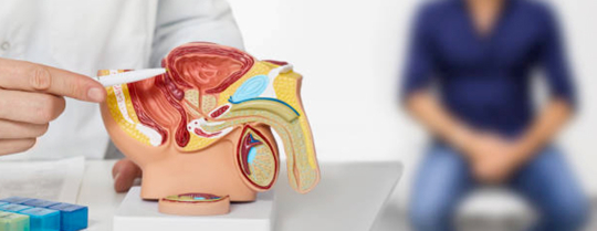Adénome de la prostate : symptômes, diagnostics et traitements