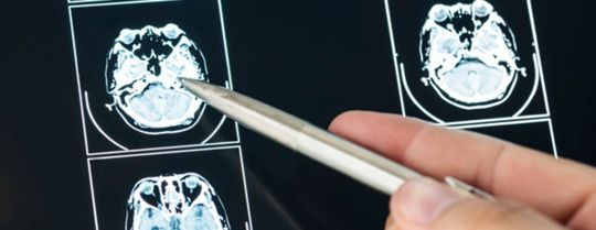 Traumatisme crânien : tout savoir sur les mesures à prendre